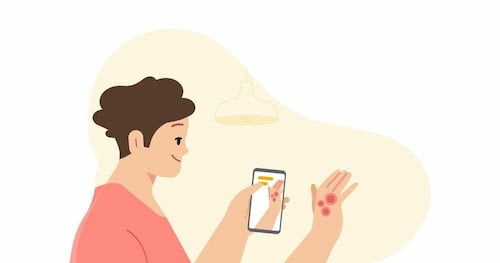 google-launch-skin-diagnosis-ai-app-2.jpeg