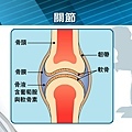 關節重建