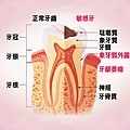 敏感性牙齒01.jpg