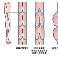 靜脈曲張靜脈曲張推薦台北靜脈曲張專科台北靜脈曲張門診台北靜脈曲張治療靜脈曲張治療推薦靜脈曲張醫生推薦靜脈曲張靜脈曲張治療靜脈曲張雷射靜脈曲張靜脈曲張怎麼辦.jpg