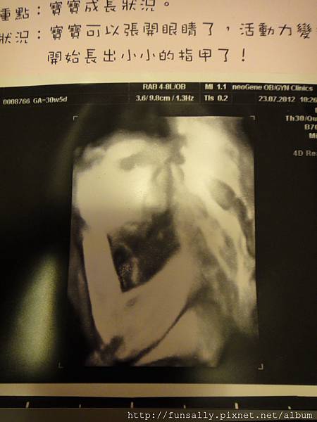 30w5d 發現很挺的鼻骨!!