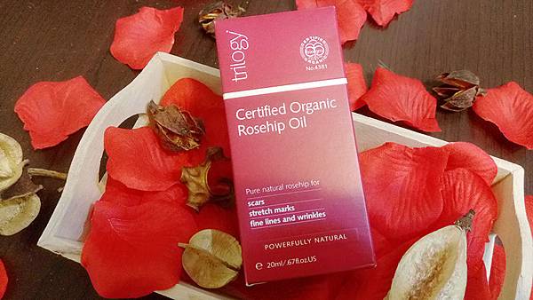 MYXJ_20170408201838_fast.jpg MYXJ_20170408201838_fast.jpg