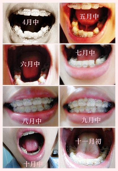 下排記錄11月