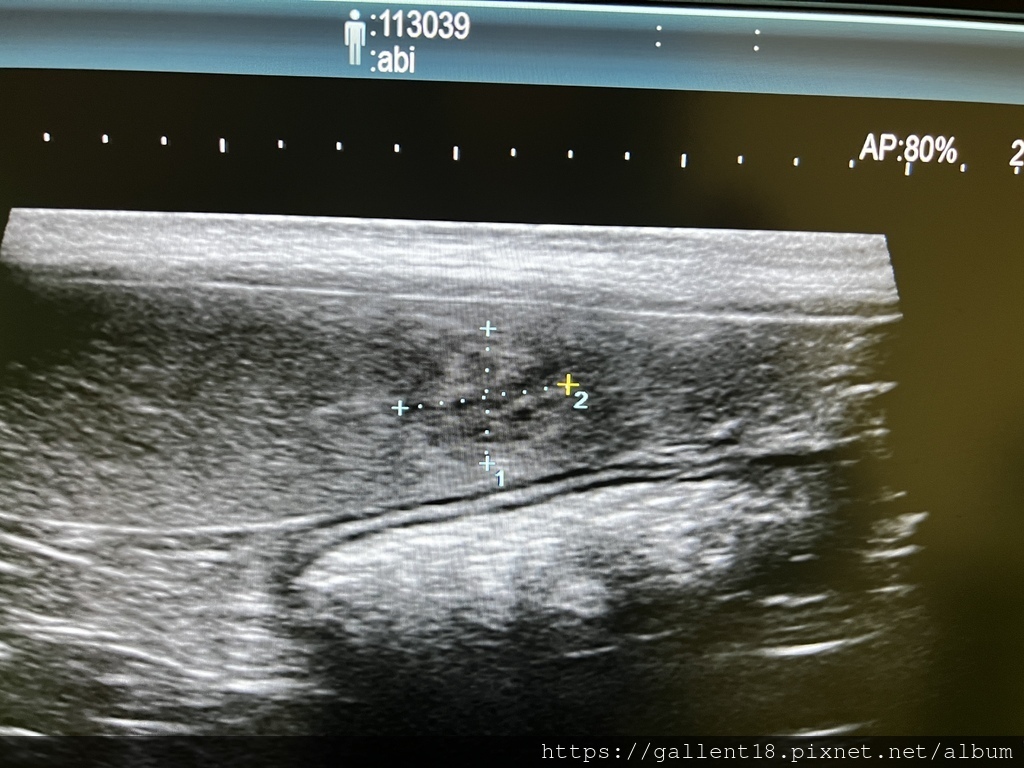 狗狗的脾臟血管肉瘤