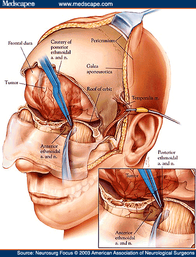 nf457741.fig2