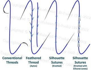 types_of_thread_lift