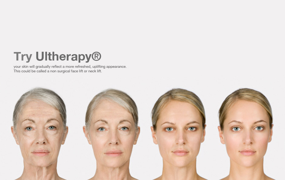 ultherapy2