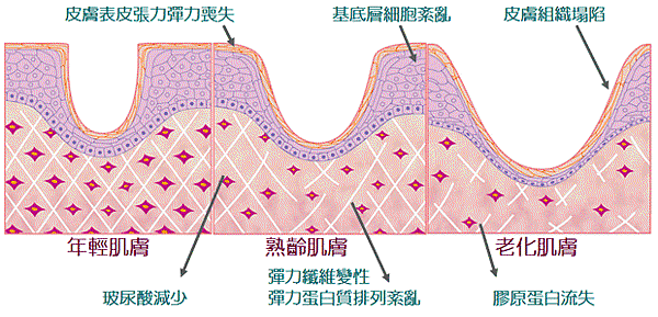 intracel_001