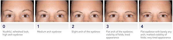 brow-positioning-grading-scale-fullwith_Breite850