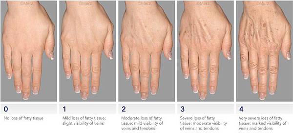 hands-grading-scale-fullwith_Breite850