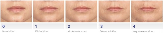 lip-wrinkles-at-rest-scale-fullwith_Contentbreite