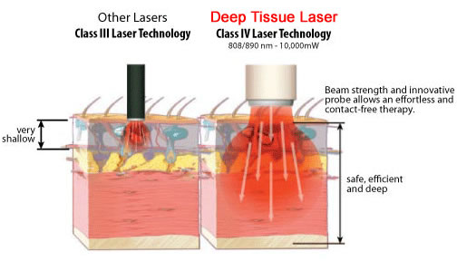 deep_tissue_healing