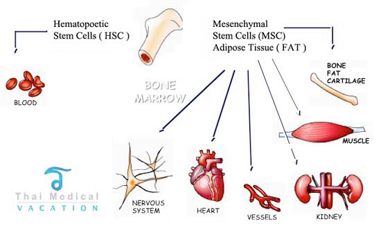 MSC-adipose-stem-cells-vs-Bone-Marrow-thai-medical-vacation