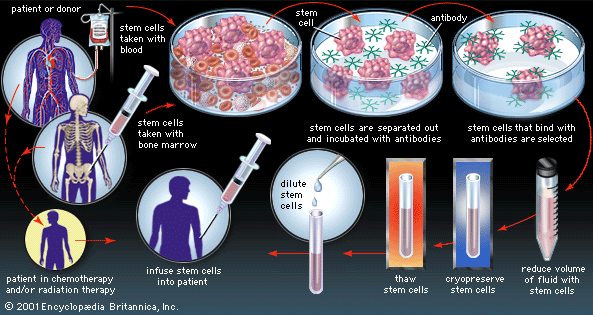 adult stem cell therapy