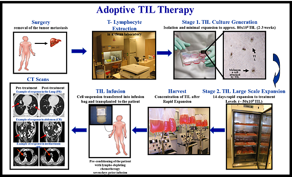 Adoptive-cell-transfer1 Adoptive-cell-transfer1