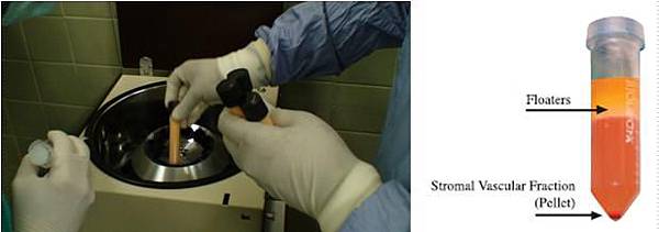 separate_fat separate_fat