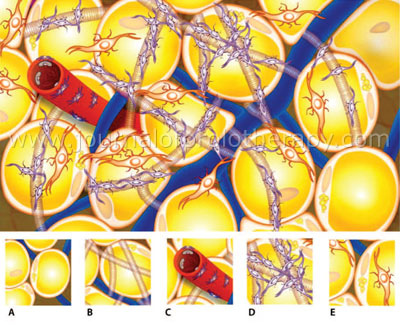 01_adipose_diagram_02 01_adipose_diagram_02