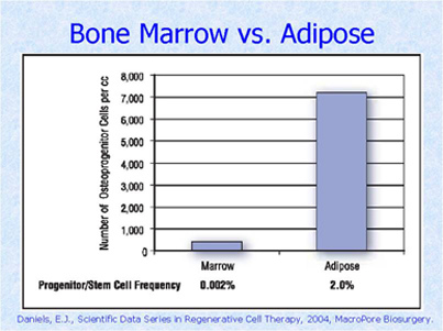 highconcentration highconcentration