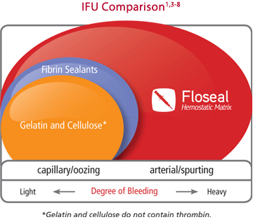 floseal-ifu-comparison