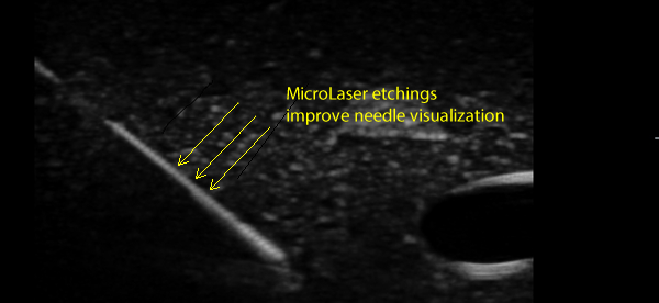 Needle-MicroLaser-Etchings