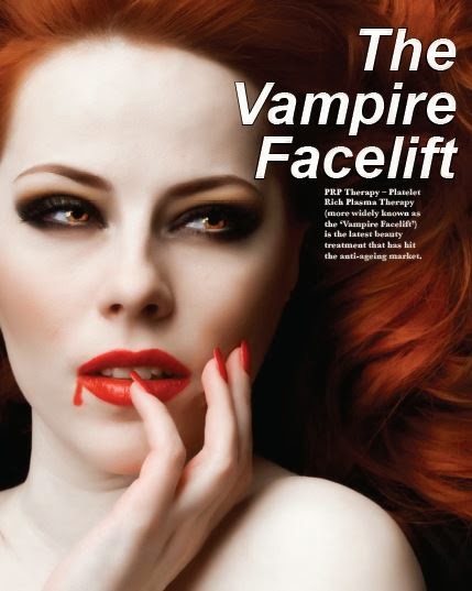 vampire facelift 1