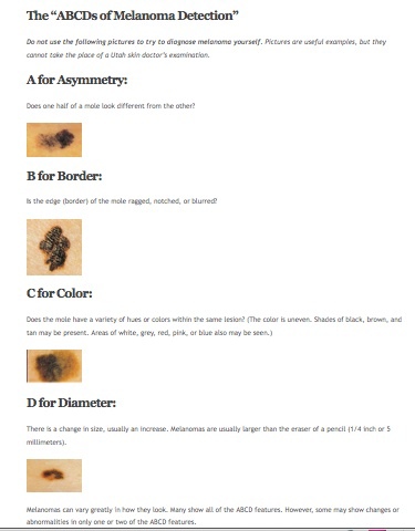 Melanoma ABCD