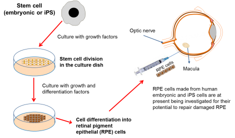 Developing eye therapies.img_assist_custom-470x276