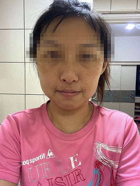 109.5雀斑_201208_4.