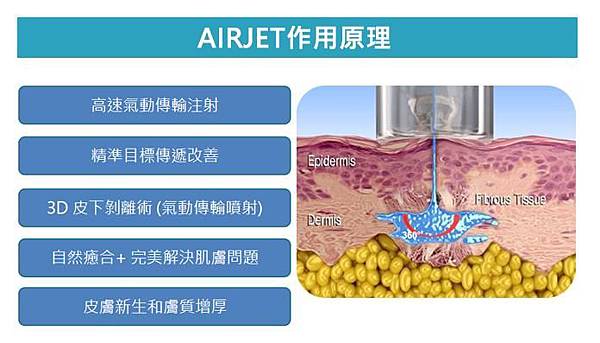 AJ 作用原理.jpg