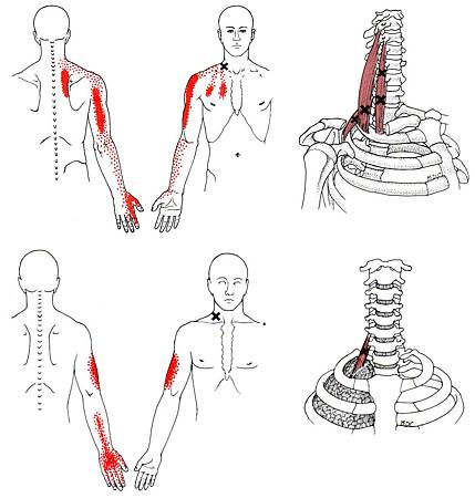 Scalene.jpg