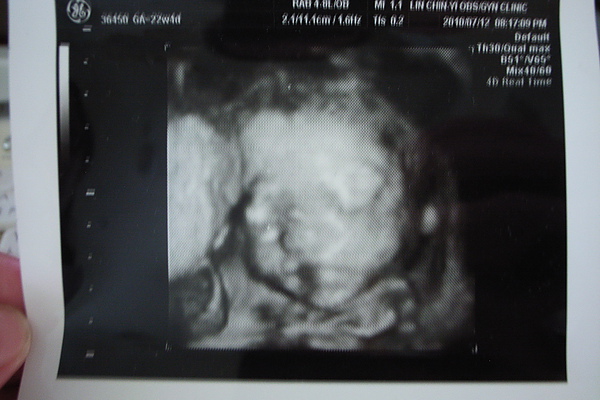 22W4D 22W4D