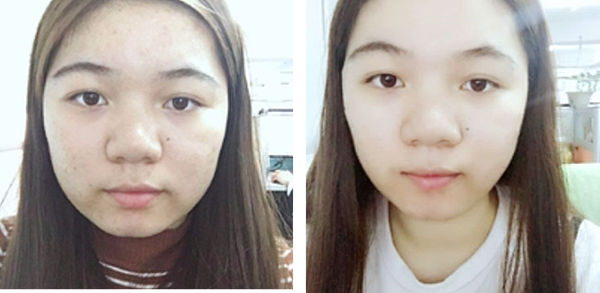 肌密能量水使用對比