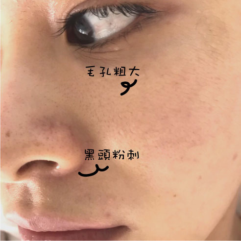 S__33677337-1