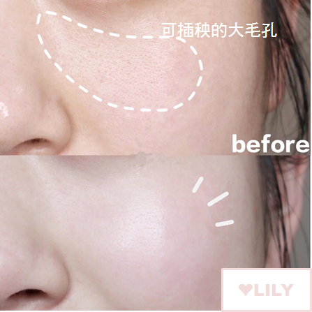 新娘最在意的痘痘、痘疤、暗沉、細紋，最有感的新娘安瓶推薦