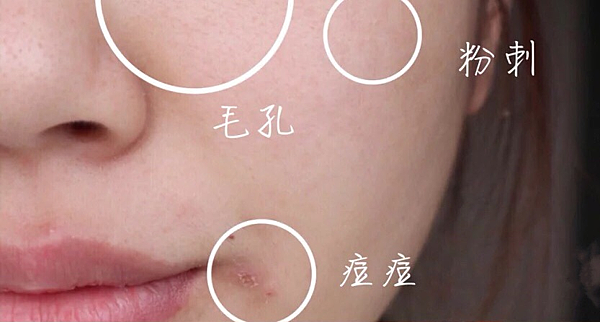 新娘最在意的痘痘、痘疤、暗沉、細紋，最有感的新娘安瓶推薦