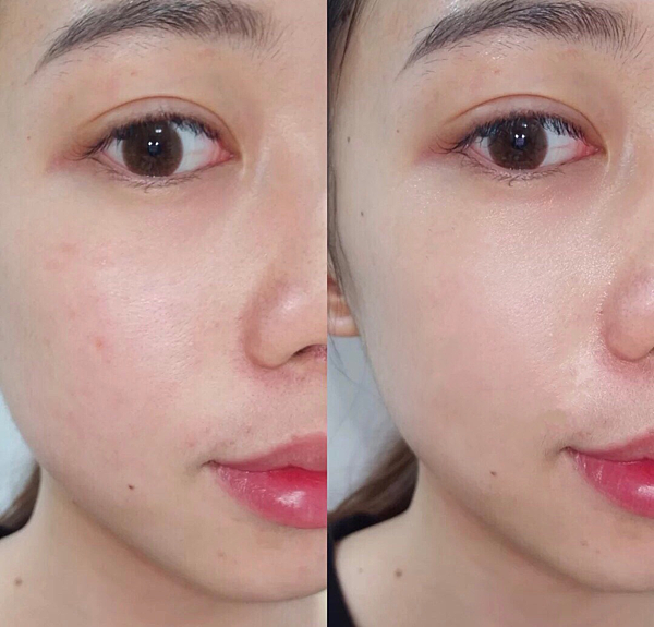 敏感肌、上妝脫皮保養推薦、脫皮卡粉怎麼辦？新娘安瓶推薦ATLA肌密青春原液