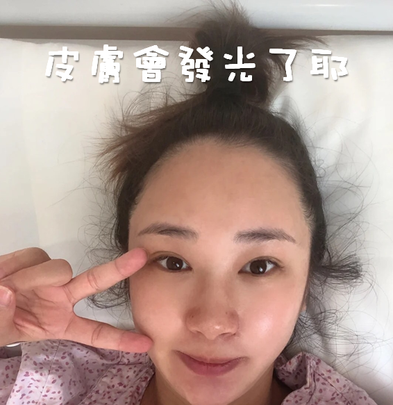 懷孕痘痘、消痘疤、下巴痘、人中痘、額頭痘保養