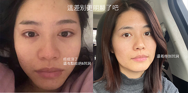 肌密能量水