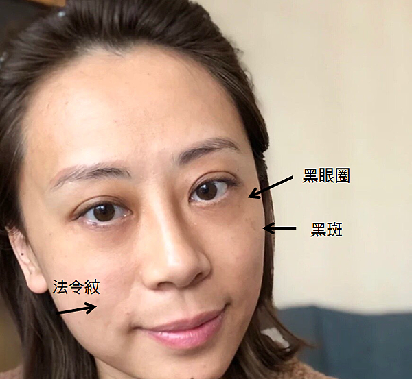 敏感肌皮膚保養推薦
