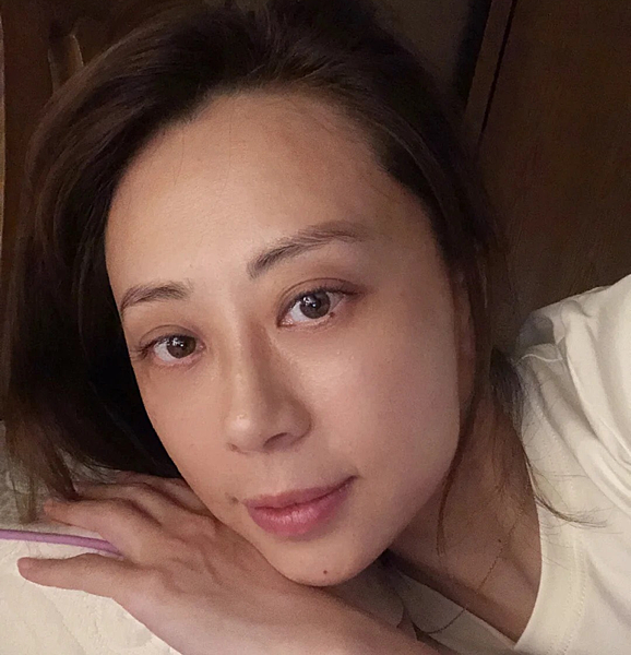 皮膚薄敏感肌保養