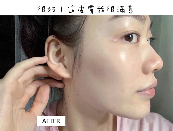 額頭痘痘、下巴痘痘、生理痘、口罩痘、油性敏感肌的私房保養清單