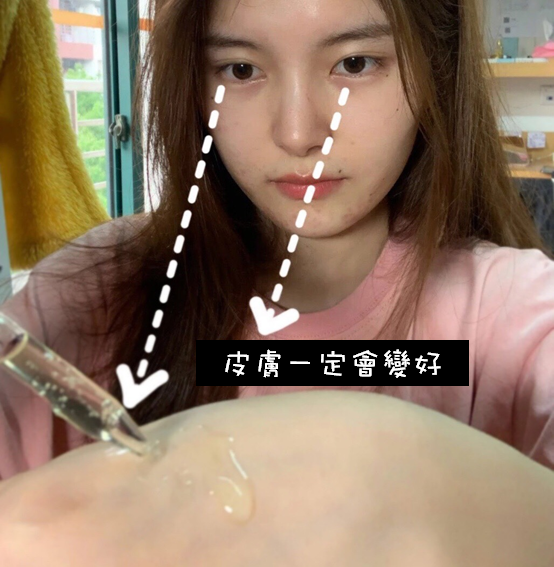 痘痘、痘疤、暗沉生理痘、壓力痘精華液推薦，淡斑、毛孔粗大、粉刺、痘疤就靠肌密能量水