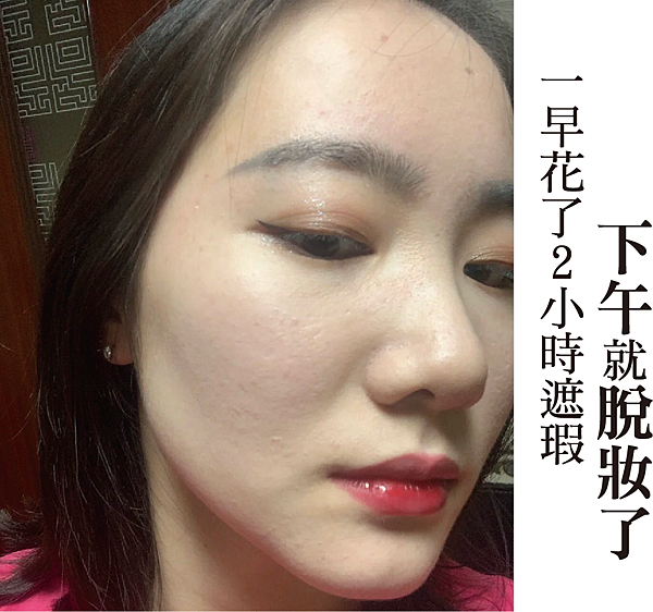敏感肌、酒糟肌、臉潮紅清爽保養推薦