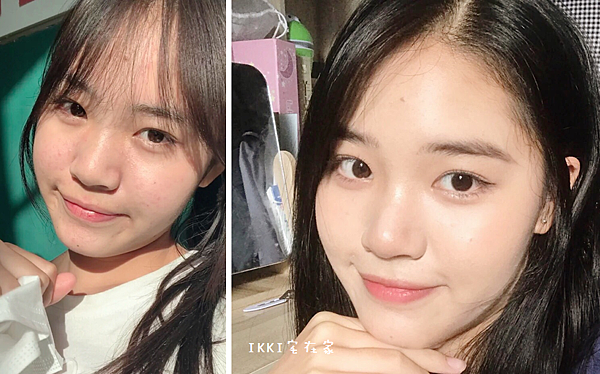 毛孔粗大卡粉、粉刺、痘疤、出油保養群組推薦