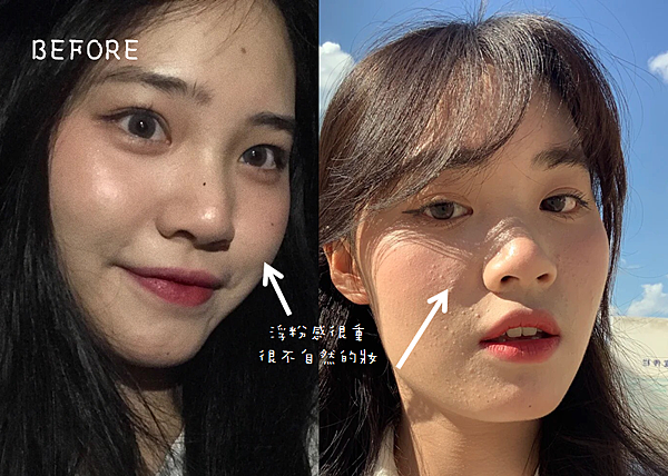 毛孔粗大、粉刺、痘疤、出油保養群組推薦