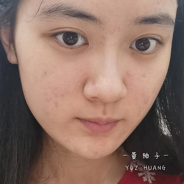 肌密能量水 痘痘改善有感 保養推薦