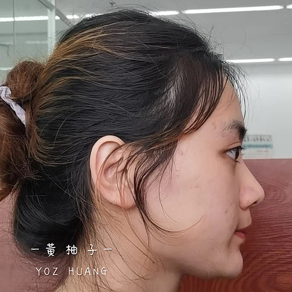 除痘疤、粉刺、毛孔粗大改善最有感精華液