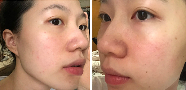運動後肌膚乾燥泛紅？敏感肌必推-療癒小藍瓶「ATLA肌密青春原液」