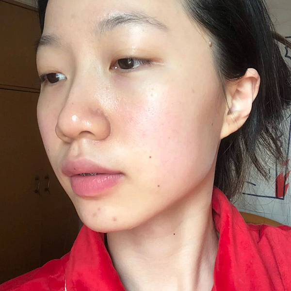 運動後肌膚乾燥泛紅？敏感肌必推-療癒小藍瓶「ATLA肌密青春原液」