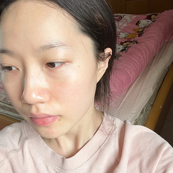 運動後肌膚乾燥泛紅？敏感肌必推-療癒小藍瓶「ATLA肌密青春原液」